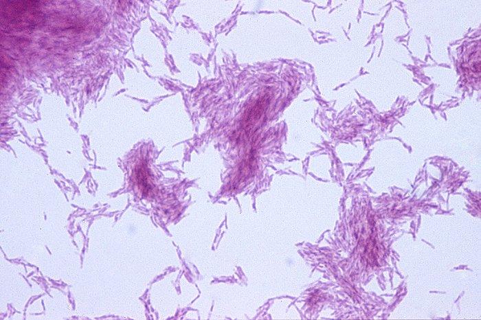 Mycobacterium kansasii Ziehl-Neelsen boyama Mycobacterium
