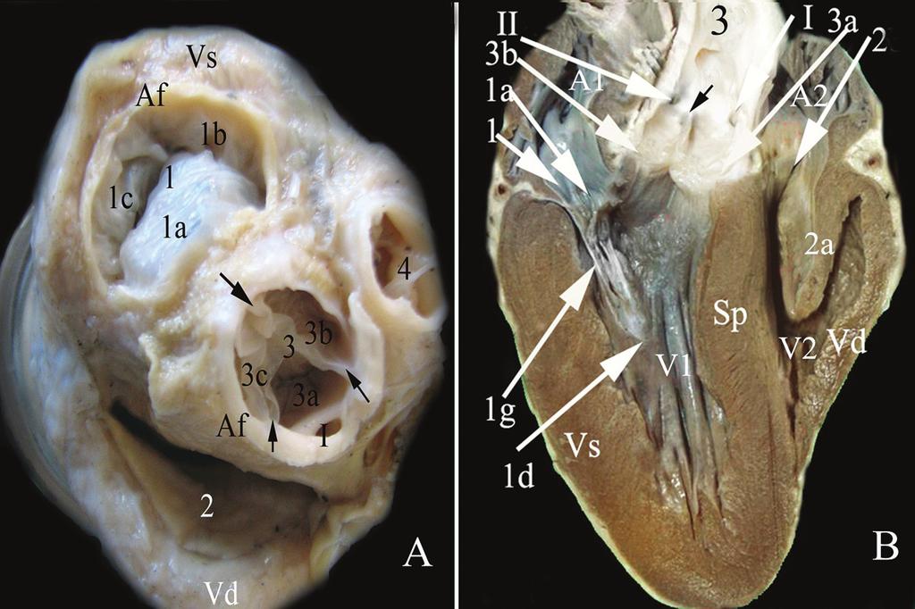 179 Şekil 1. A: Atrium lar uzaklaştırıldıktan sonra kalbin dorsal den görünümü, B: Kalbin sagittal kesit görünümü (soldan görünüm).