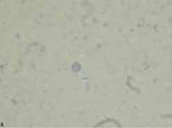 26 7-33 Entamoeba coli - 1-1 Giardia intestinalis 1 - - 1 Enterobius vermicularis 1 - - 1 DHB: Demir hemotoksilen boyama, TB: Trikrom boyama, PCR: Polimeraz zincir reaksiyonu, QPCR: Kantitatif