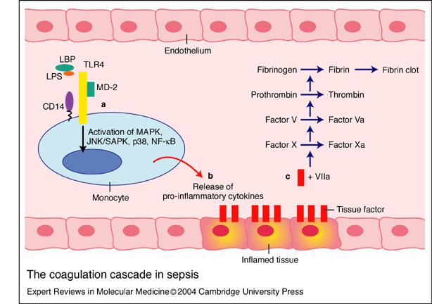 Sepsis ve DIC Sepsis