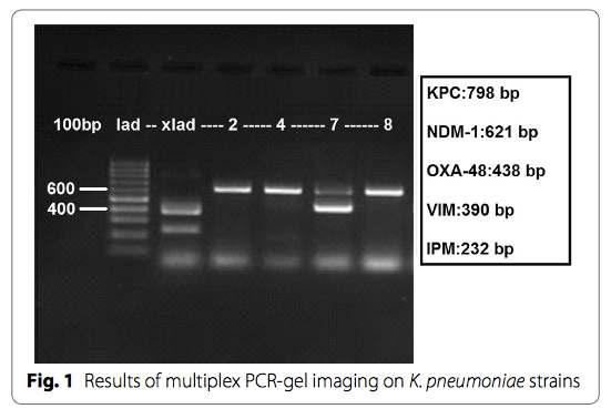 Karbapenemaz direnç genleri multiplex PCR ve gel görüntüleme