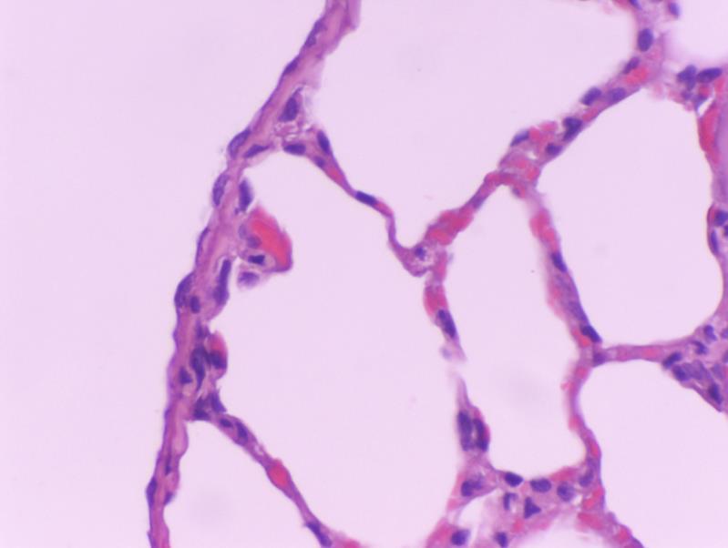 Şekil 8.Sıçan akciğerinde normal pleura yapısının ışık mikroskobik görünümü, HE X40 MİKROVİLLUS VE YAĞLI MEMBRAN Mikrovilluslar, tüm yüzeyde bulunur. Hafifçe birbiri üzerine döner.