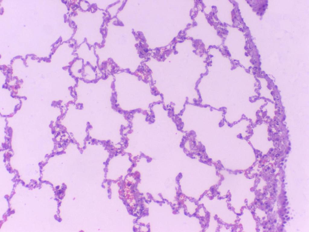 Pariatal pleura, kotsalar üzerinde çok katlı mezotelyal hücre içerir, 5.tabaka kosta periostuna tutunur. Diğer pariatal bölgelerde 5.tabaka zayıf veya yoktur.