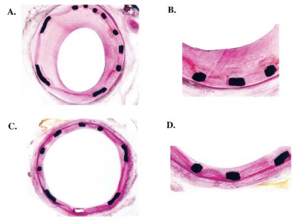 Şekil 4: Normal domuz koroner arterlerine yerleştirilen stentlerin 28. gündeki düşük ve yüksek çözünürlükteki mikroskopik görüntüleri.