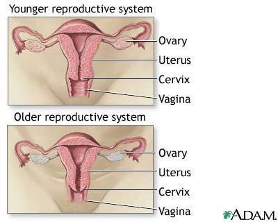 Vaginal atrofi Semptomlar Disparoni (ilişkide zorlanma-ağrı)