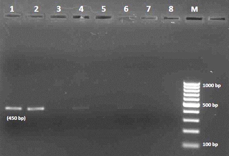 3. BULGULAR 3.1. PCR Bulguları Çalışma kapsamında toplam 22 örnekte PCR ile beklenen boyutta bant görülmüştür.