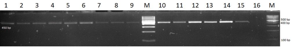 Şekil 5. Bazı E. granulosus izolatlarının PCR sonrası jel görüntüsü (1-15 pozitif izolatlar, %1,5 agaroz jel, 90 V, 30 dk., M: markır; 100bp, Fermentas) 3.