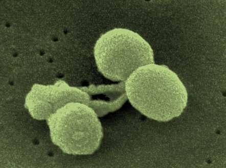 Streptococcus pneumoniae, Toplumda Gelişen Pnömoni, Menenjit ve Baktereminin başlıca nedeni Organizmanın polisakkarid kapsülü vardır.