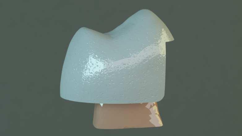 45 Şekil 3.5. Endokron restorasyon imajı Modifiye Endokron Bu modelde pulpa odasına ek olarak bukkal ve palatinal kök kanallarından da