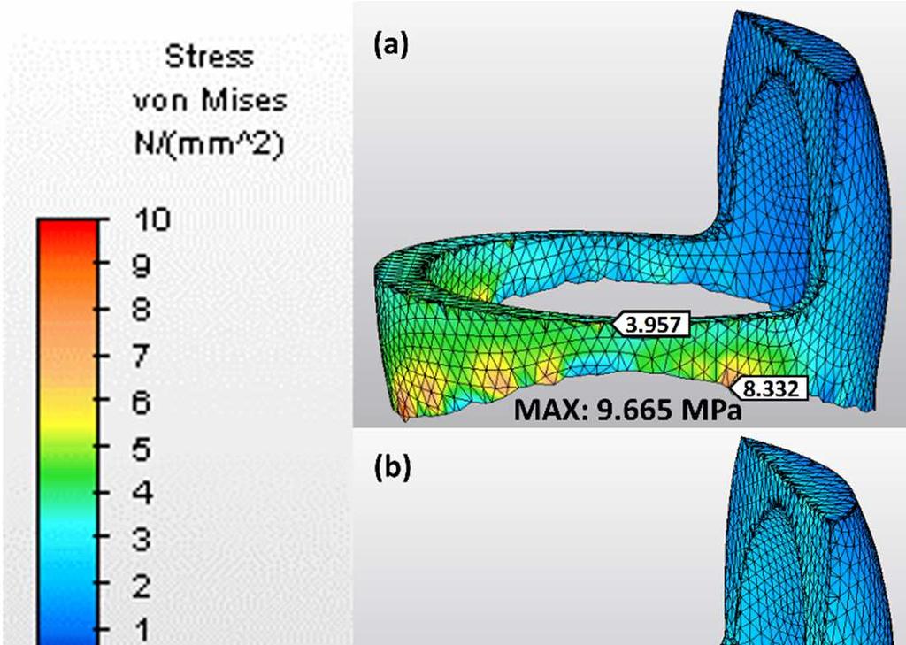 55 3 farklı CAD/CAM materyalle restore edilen modifiye endokron modelde materyallere göre stres miktarları ve dağılımı şu şekildedir; Materyaller arası maksimum von Mises stres birikimi sırasıyla