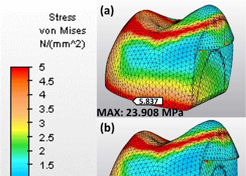 80 4.3. Restoratif Materyalde Oluşan Stres Bulguları 4.3.1.