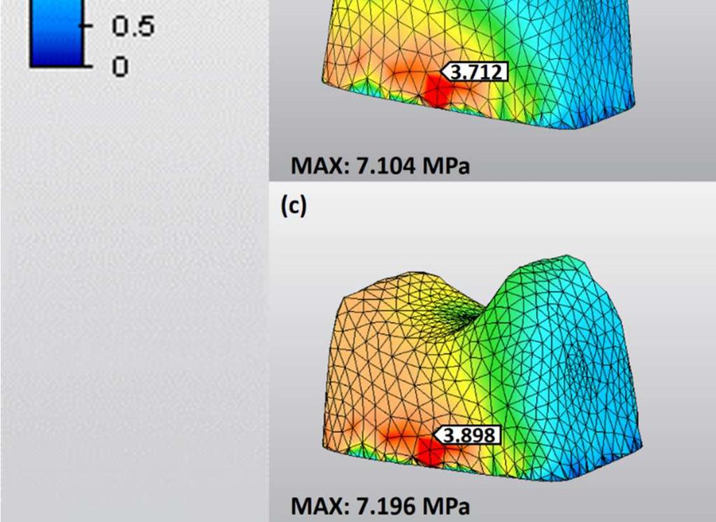 modelde materyaller arası stres değerleri sırasıyla şöyledir: VE (19.884 MPa) > VMII (19.188 MPa) > LU (14.