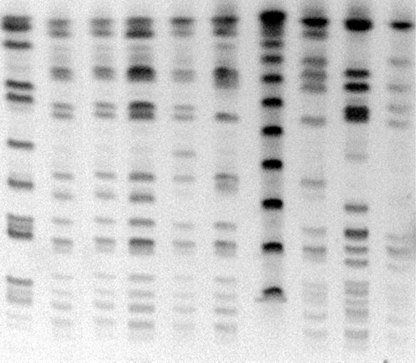 Pulsed Field Gel Electrophoresis (PFGE) : Kromozomal DNA içeren kalıp örneklerinin üçte biri, uygun tampon içerisinde 3 saat süreyle, 30 U SmaI restriksiyon endonükleazı ile 37 C de kesilmiştir.