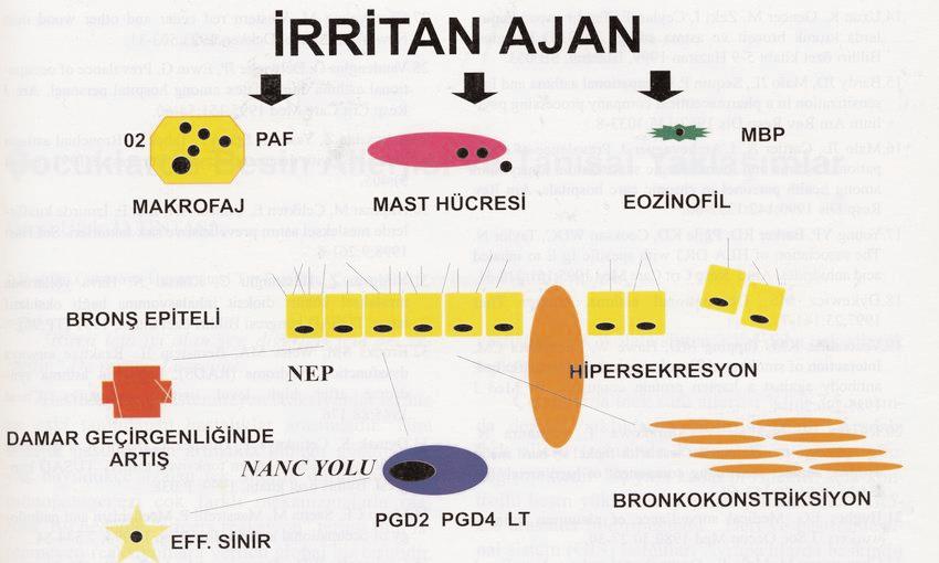 MESLEK ASTIMI ETYOPATOGENEZİ Şekil 2. RADS patofizyolojisinin hipotezi (27) (Cockcroft WD, Dosmann AJ. Med Clin North Am 1996; 8:749-73 den alınmıştır.