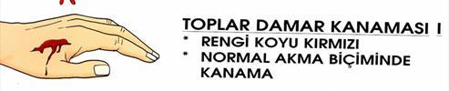 B) Dış kanama: Kanın yaralanmalar sonucunda vücut dışına çıkmasına denir ve atardamar, toplardamar ve kılcal damar kanamaları olarak üç ayrılır.