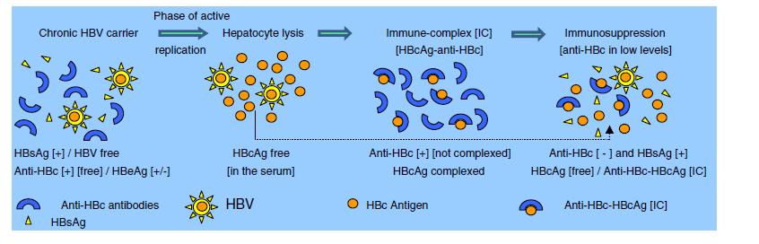 Kronik infeksiyonda HBsAg pozitif iken AntiHBc negatif olmasının bir diğer nedeni serumda HBcAg-antiHbc komplekslerinin oluşumudur.