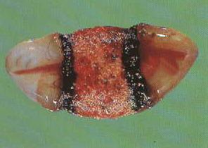 Tam Plasenta 1. Placenta endothelio-chorialis, desiduata, villosa zonaria: *Carnivorlarda görülür. *Tilkide koryon frondozum iki kemer halindedir. *Köpekte plasenta gebeliğin 17. kedide 12.