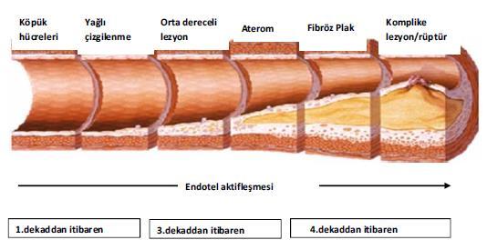 Şekil 1. Ateroskleroz erken yaşlarda itibaren gelişimi (14) Ateroskleroz; büyük ve orta boyuttaki arterlerin, temel olarak intima tabakasına yerleşen, kesintisiz bir süreçtir.