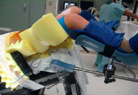 Ro ot Yardı lı Laparoskopik Cerrahi Cerrahi Teknik Hasta pozisyonu Hedef organ ve hasta boyutu Pel ik prosedürlerde