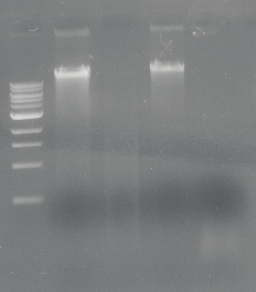 Elde edilen en iyi sonuçlar bakteri/fungal DNA kitinden elde edilmesiyle bu kitin kullanılmasına karar verilmiştir.