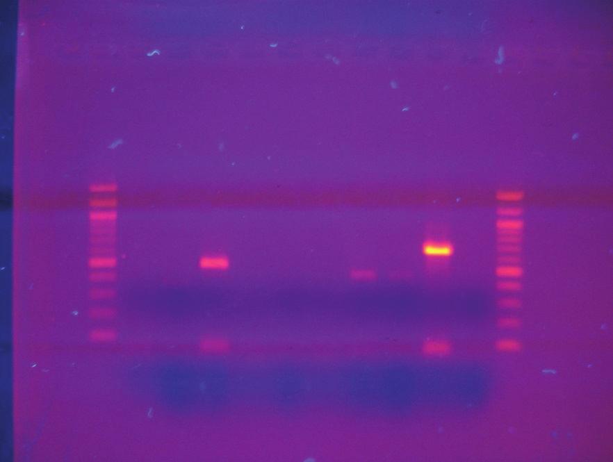 57 farklı PCR kiti kullanılmıştır. İlk kullanılan Roche (FastStart Taq DNA Polymerase, dntpack) marka kitin içerisinde bulunan DNA Polimeraz enziminin çalışmaması nedeniyle sonuç alınamamıştır.