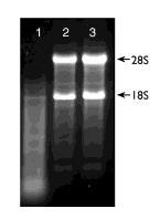 Parçalanmış RNA 15.3.2016 Parçalanmamış toplam RNA jel üzerinde oldukça belirgin 28S (veya 23S) ve 18S (veya 16S rrna bantlarına sahiptir.