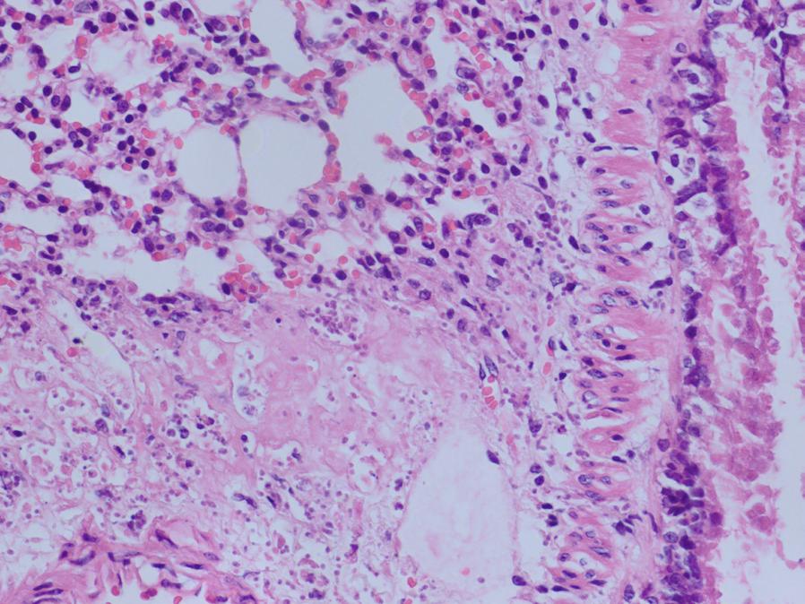 Grey exudative fibrinous membranes focally or diffusely covering the surfaces of the liver, spleen, gut and kidneys were observed (Figure 1, 2 a, 2 b). Similar findings were seen Group II, too.