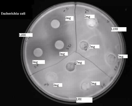 4 de sırasıyla Bacillus subtilis, Staphylococcus aureus, E. gallinarum ve E.