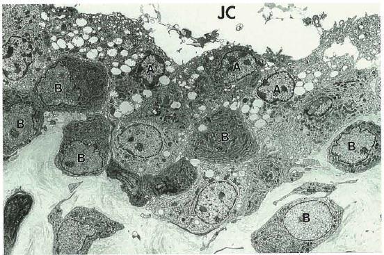 ġekil 2.11 Sinoviyositlerin iki tipinin elektron mikroskobik görüntüsü. Tip A hücreler vakuollerden zengin olup sinoviyal intimanın yüzeyel tabakasında yerleģmiģtir.