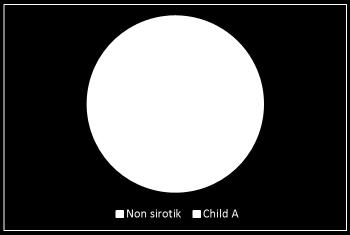 Non siro_k 105(%92,9) hasta Child A sirozlu 8(%7,1) hasta