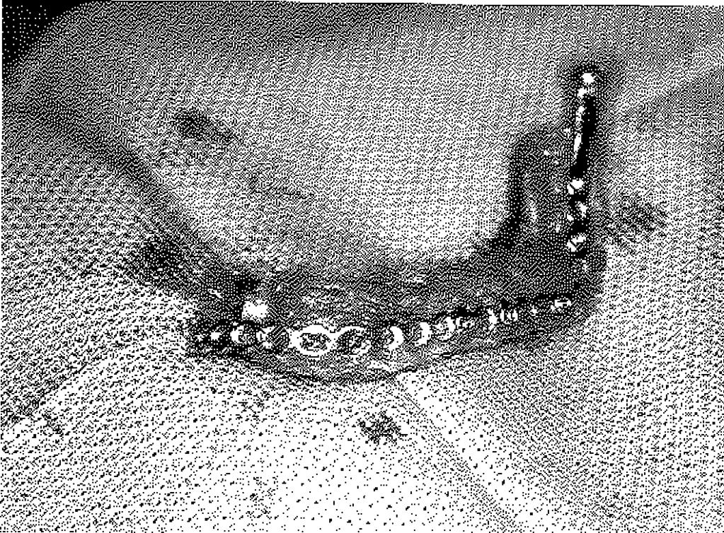 ayda protetik restorasyondan sonra oldüzyonun görünümü. Şekil 2: Olgunun postoperatif 18. ayda panoramik grafisi. skalp flebi ile bukle al yöre onarımı yapıldı.