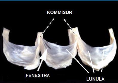 Yarım ay (semilunar) şeklindeki her üç aort kapakçığı cep şeklinde avasküler doku flepleri oluştururlar.