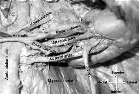 olarak böbrek hilumundan ayrılan renal ven görüldü (Şekil 1, 2). Üst renal arter renal venin iki kökü arasından geçerek; alt renal arter ise üreterin altından geçerek böbrek hilumuna giriyordu.