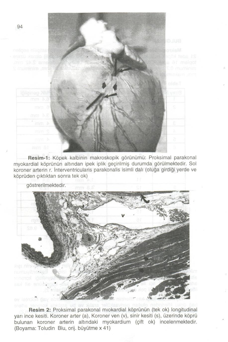 94 Resim-1: K6pek kalbinin makroskopik g6ronomo:proksimal parakonal myokardial k6prononaltmdan ipek iplik gegirilmi~ durumda g6rolmektedir. Sol koroner arterin r.