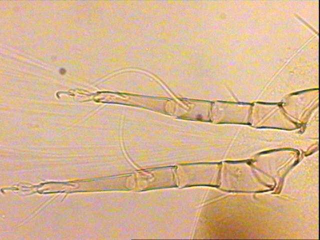Şekil 3.5 Carpoglyphus lactis (Lineé1758) dişi bireyde tarsus ve pretarsus yapısı(x20) Şekil 3.