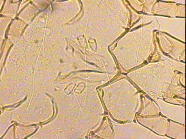 2004 idiosoma uzunluğunu 363 ± 15,01(290-550); eni ise: 215,25 ± 10,7(155-330) µm olarak belirlemiştir. Erkek birey vücut karakterleri olarak dişiye benzer.