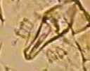 Şekil 3.8 Carpoglyphus lactis (Lineé,1758), erkek bireyde genital tutunucuların görünüşü (x20) 3.1.2 Biyolojik gözlemlerde kullanılan mikro hücreler Değişik sıcaklık ve orantılı nem kombinasyonlarında C.