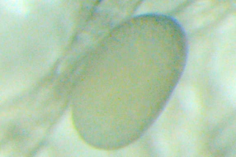 4. ARAŞTIRMA BULGULARI VE TARTIŞMA 4.1 Carpoglyphus lactis in Biyolojisi C. lactis genel olarak ergin oluncaya kadar yumurta, larva,protonimf, deutonimf, tritonimf ve 4 sakin dönem geçirmektedir.