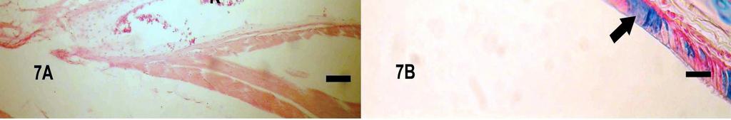 A ve B Faringeal (FB) ve laringeal bezlerde (LB) zayıf ve kuvvetli sülfatlı musinlerin