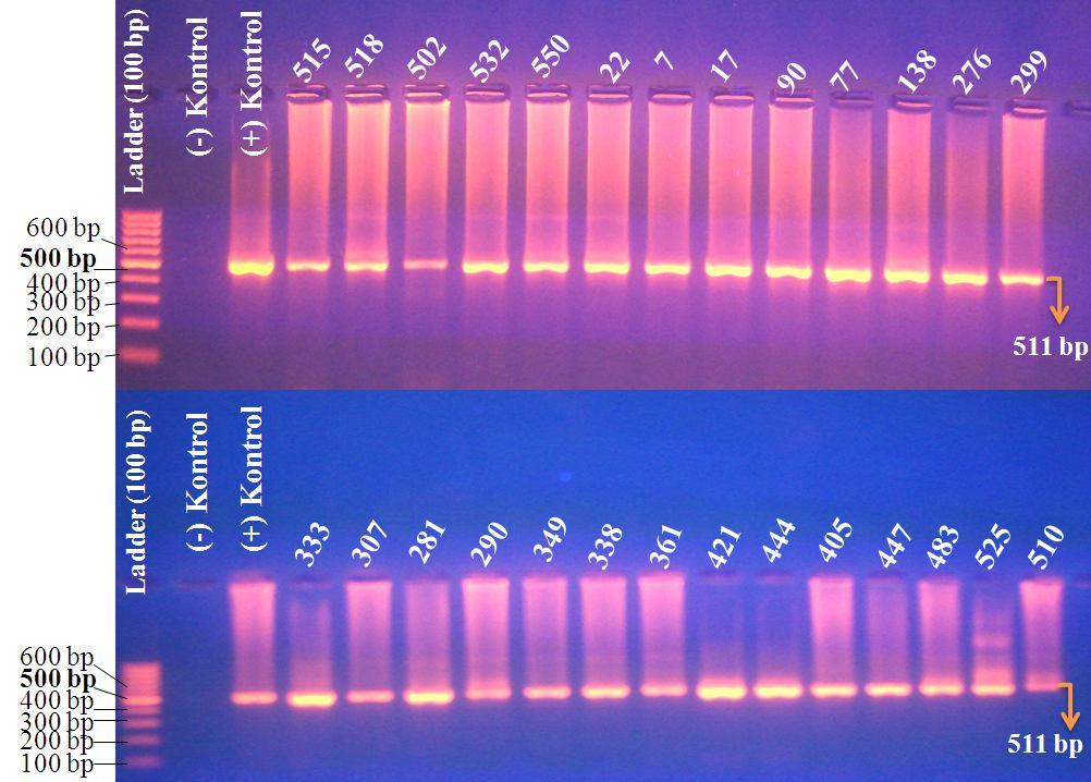 Şekil 4.2. Nested PCR işleminde pozitif çıkan numunelere ait PCR ürünlerinin (511 bp) %2 lik jel elektroforez görüntüsü.