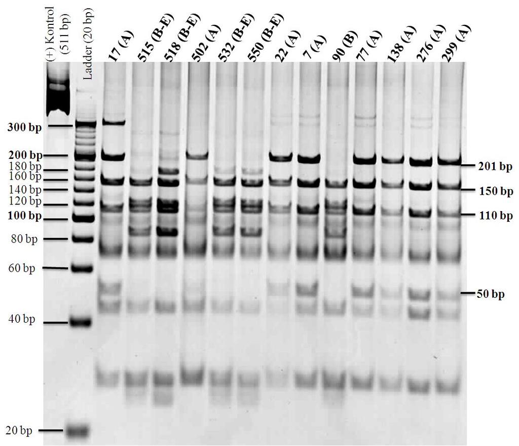 Şekil 4.3. HaeIII enzimi ile kesilen 13 örneğe ait restriksiyon ürünlerinin PAGE (%12) görüntüsü.