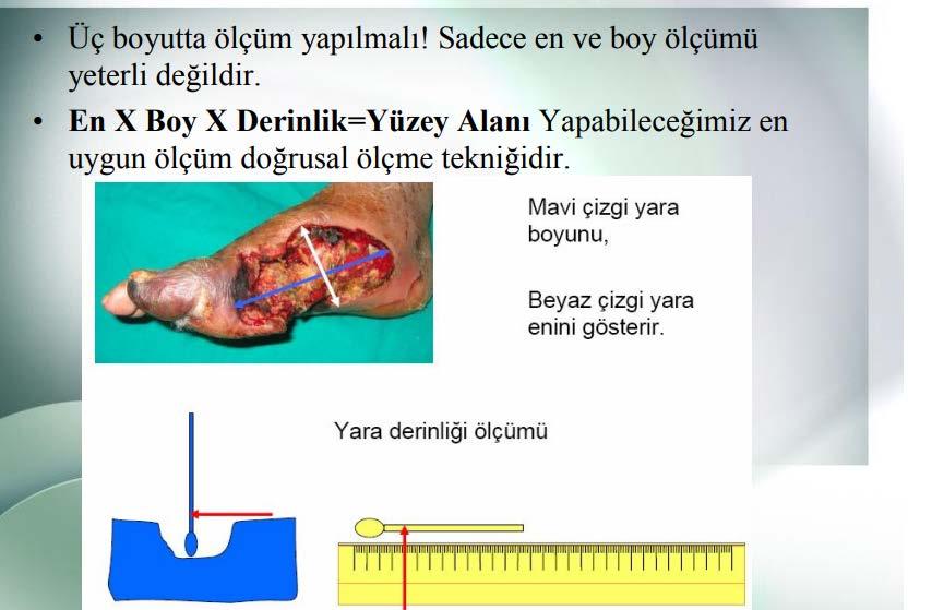 EVRELENDİRİLEMEYEN BASINÇ ÜLSERİ *Tam kalınlıkta doku kaybı vardır.