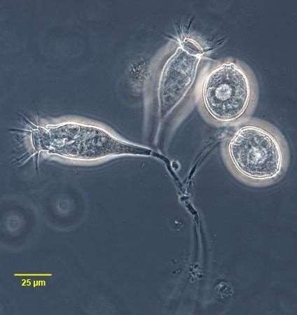 Opercularia sp. 45 Suctoria spp.: 10 ɱm uzunluktadır. Hayatlarına serbest yüzen siliatlar şeklinde başlarken, daha sonra sabit hal alırlar.