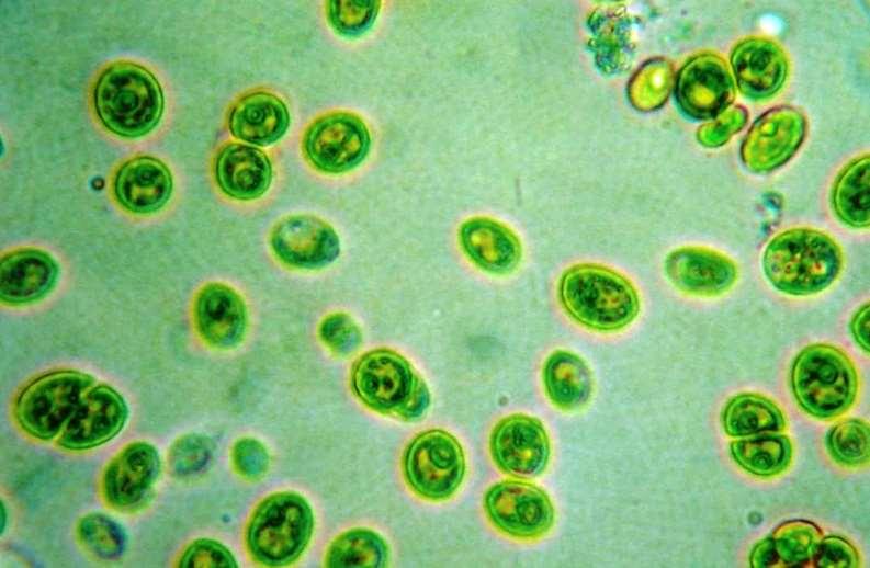 Mavi yeşil alg türleri çok çeşit şekillerde ve boyutlarda olabilir. Tek hücreli bulunabildikleri gibi koloni şeklinde veya trichomes gibi adı verilen flament formları şeklinde gözlemlenebilirler.