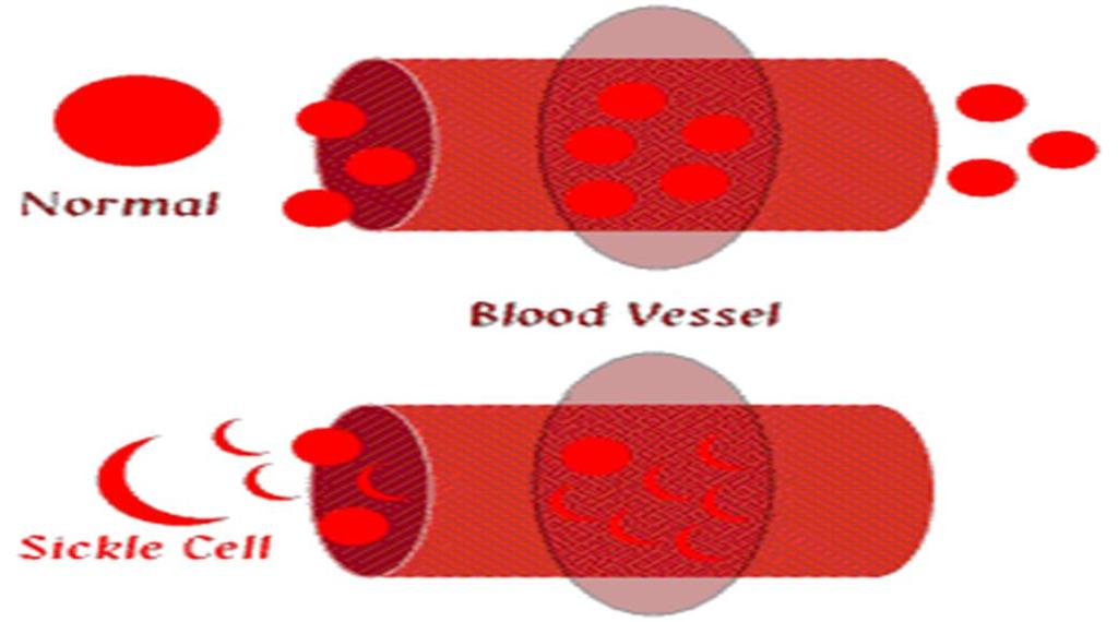 Hastanın kanındaki kırmızı kan hücrelerinin, kanının tıbbi bir cihazdan geçirilmek sureti ile diğer kan bileşenlerinden ayrılarak