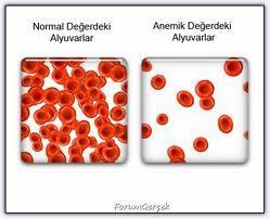 Otoimmün hemolitik anemi (OĐHA), hastanın kendi eritrositlerine karşı antikor üretmesi sonucunda, eritrositlerin parçalanması