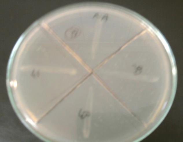 59 4.1.2. Elastaz enzim varlığının araştırılması Çalışmada, çiğ sütten izole edip adlandırdığımız laktik asit bakterilerinin Elastinli Nutrient Agar da elastaz enziminin varlığı araştırılmıştır.