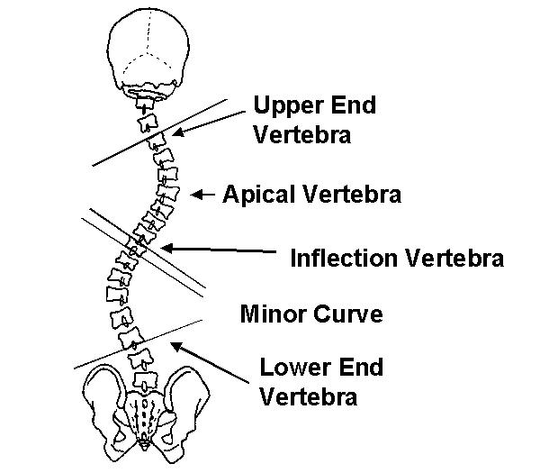 Terminoloji Üst End vertebra :