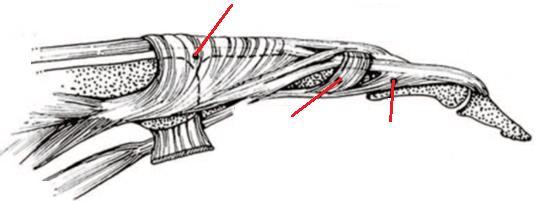 Santral Slip Metakarpofalangeal Eklem Saggital bant Proksimal Interfalangeal Eklem Distal Interfalangeal Eklem Transvers Retinakuler