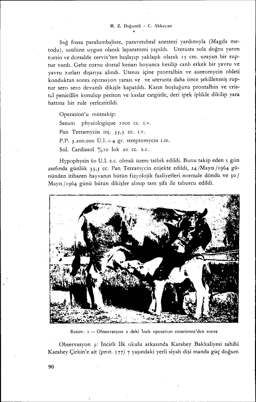 Mo Z. Doğaııcli -c. Akkayaıı Sağ fossa paralumba.1iste, paravetebral anestezi yardımıyla (Magda metodu), usülüne uygun olarak laparatomi yapıldı.